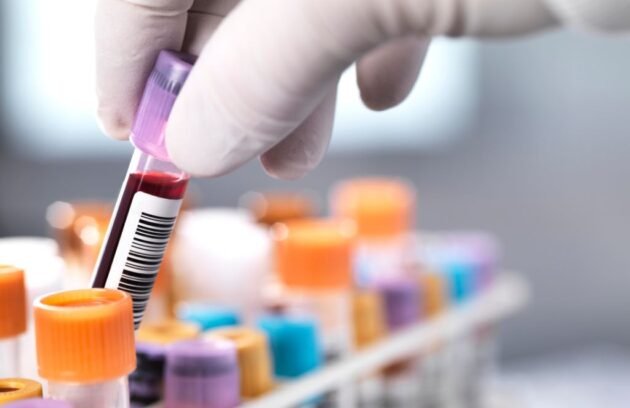 Diagnostic Centre in Guwahati