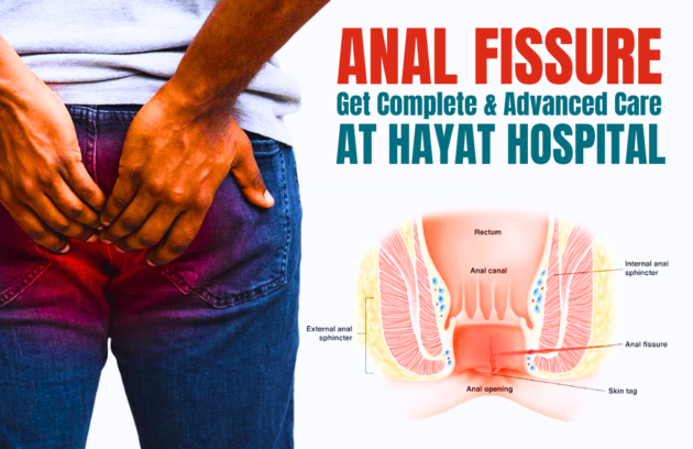Anal Fissure Surgery in Guwahati