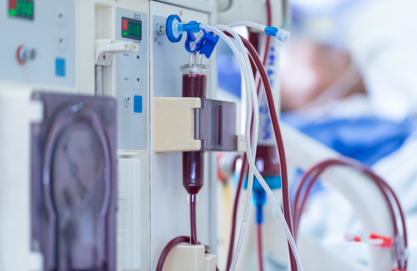Best Dialysis Centre in Guwahati