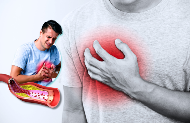 Heart Attack Treatment in Guwahati